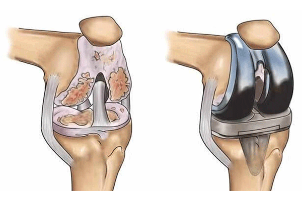 مرکز فوق تخصصی جراحی مفاصل