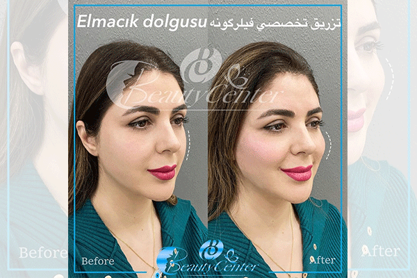 بیوتی سنتر