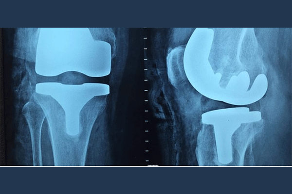 ارتوپد دکتر بیژن بهروان Dr. Bijan Behravan Orthopaedist