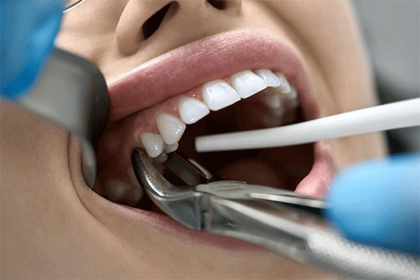 دندانپزشک دکتر نادر احسانی Dr. Nader Ehsani Dentist