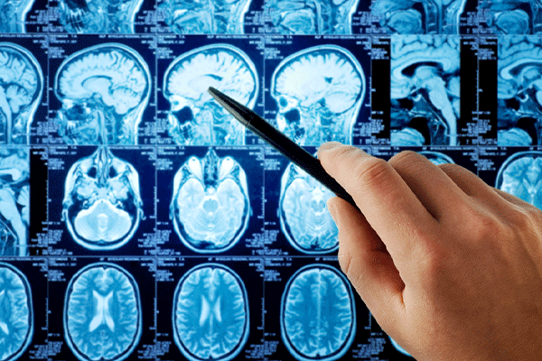 متخصص مغز و اعصاب دکتر کریستال س. جانانی / Dr. Crystal S. Janani Neurologist