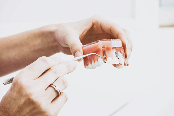 دندانپزشک دکتر نوشین انتظامی Dr. Nooshin Entezami Dentist