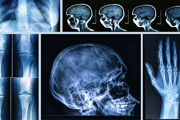 رادیولوژیست دکتر نیلوفر مجذیان  Dr. Niloufar Mojdehian Radiologist