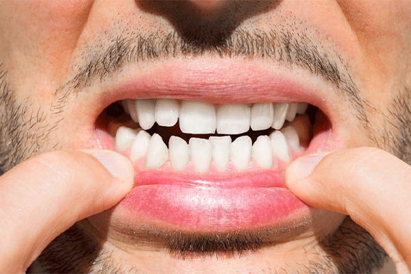 دندانپزشک دکتر ساسان تهرانی