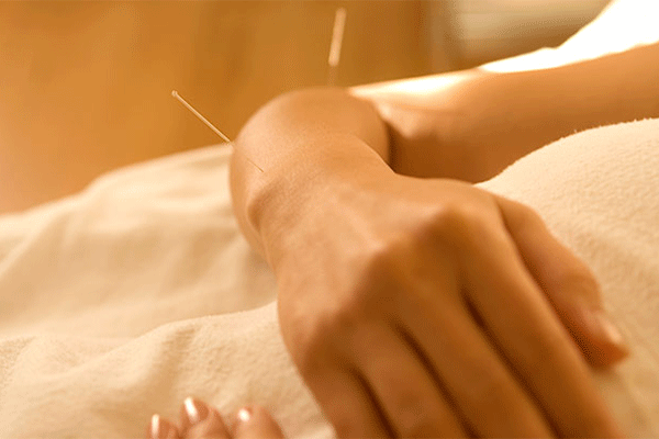 پزشک عمومی و طب سوزنی دکتر سمیرا مجلسی Dr. Samira Majlesi General&PractitionerAcupuncture