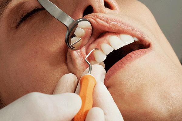 دندانپزشک دکتر زهرا حسینی Dr Zahra Hosseini Dentist