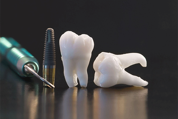دندانپزشک دکتر شادی گوتیه کی مرام Dr. Shady Gautier Keymaram Dentist