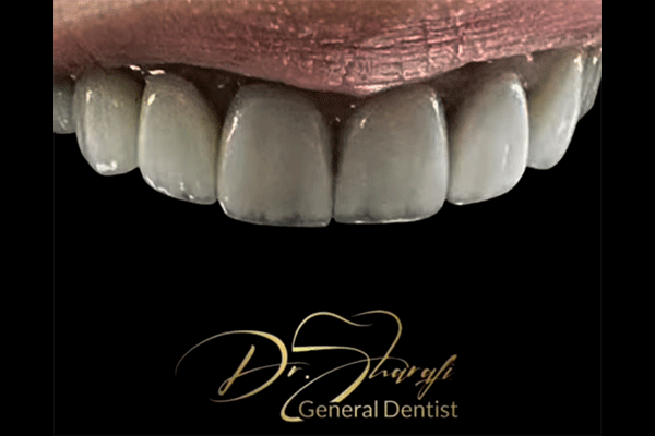 دندانپزشک دکتر محبوبه شرفی Dr Mahbobeh Sharafi Dentist