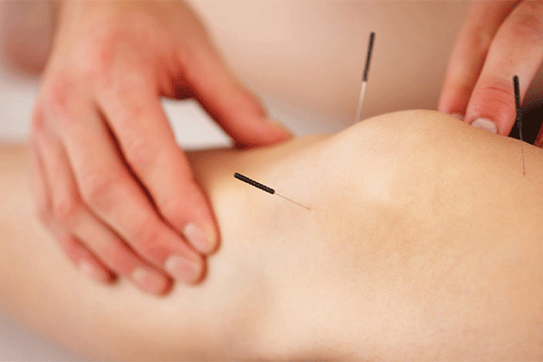 طب سوزنی دکتر هدیه باغ خواستی