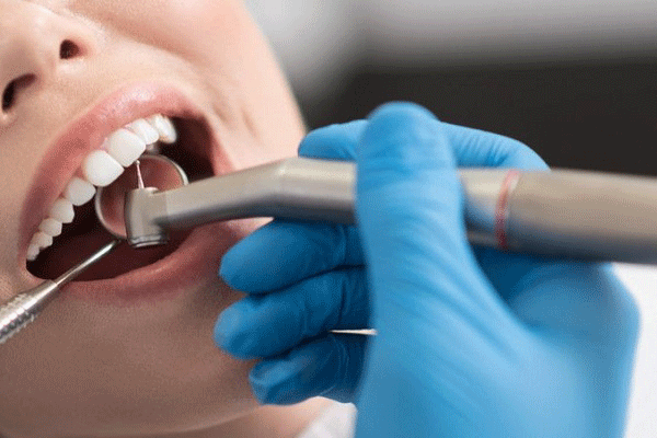 دندانپزشک دکتر رعنا عابدی Dr. Rana Abedi Dentist